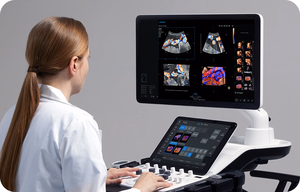 Samsung Medison ultrasound system