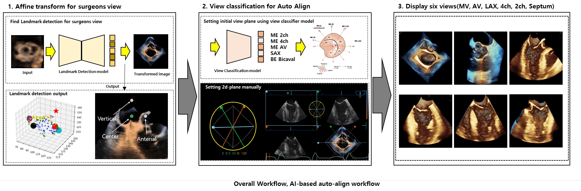 Ultrasound AI Inference preview